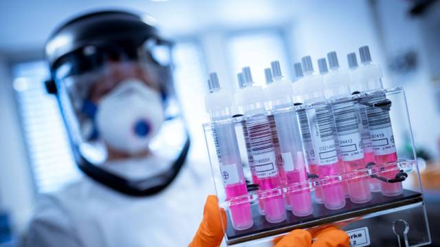 En lo que va de 2025, las autoridades sanitarias registran 302 casos de tuberculosis